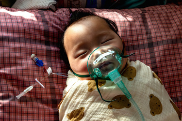 A city gasps for air