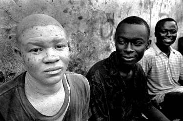 Haitian Albino youth with his friends.