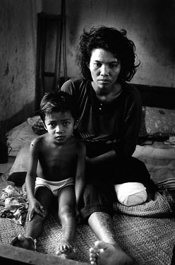 Young boy with his mother, a land mine victim, in Kompong Chnang hospital. There is nobody else to take care of him.