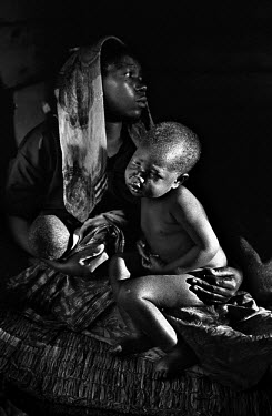Kitshanga village. Mother with two sick children on arrival at the Medecins Sans Frontieres (MSF) feeding centre after a day's walk. Since the conflict began it is estimated that 2.5 million people ha...
