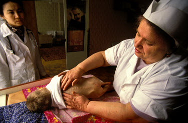 Child at the Semipalatinsk orphanage receiving physiotherapy. Many have severe problems with their central nervous system or have Down's Syndrome. On 29th August 1949 the first Russian plutonium bomb...