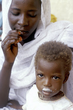 Undernourished child with his mother on a feeding programme funded by the Lutheran World Federation (LWF).