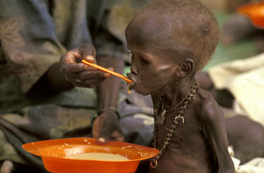 Mother feeding her malnourished child at an MSF (Medecins Sans Frontieres) therapeutic feeding centre. The 1998 famine in Southern Sudan affected around 2.6 million people. In the worst-hit region of...