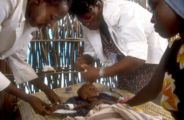 A nurse and doctor struggle to save the life of a child while its mother watches anxiously. Over 64,000 Somalian refugees fleeing famine were housed in the Libo refugee camp.