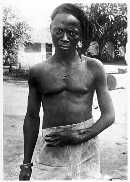 Lomboto shot in wrist and hand by a rubber concession sentry and permanently disabled as a result. The Belgian Congo under King Leopold II employed mass forced labour of the indigenous population to e...