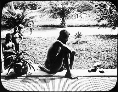 Nsala of Wala with the severed hand and foot of his five year old daughter murdered by ABIR militia. (Anglo-Belgian India Rubber company) This was all that remained that remained of a cannibal feast f...