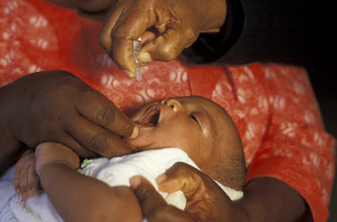 A baby receiving an oral vaccination against polio.