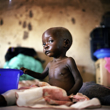 Evelyn Akite, aged 18 months, is severely malnourished but is getting better due to treatment at the Lira therapeutic feeding centre, run by MSF (Medecins Sans Frontieres).~For 18 years the Lord's Res...