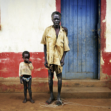 Father and son in Awere camp for internally displaced people (IDPs), wearing rags.For 18 years the Lord's Resistance Army (LRA) rebels have terrorised the Northern provinces of Uganda abducting 20,000...