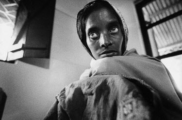 A young woman suffering from tuberculosis (TB).