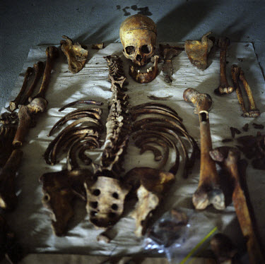 The bones of a Bosniak man are laid out at the Re-Association Centre in Lukavac as part of an identification process that uses DNA matching to try to reassemble bodies unearthed after the massacre.An...