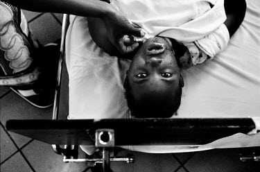 Sophia Selemani recoveres from sugery at the German-run Disability Hospital CCBRT (Comprehensive Community Based Rehabilitation Tanzania).  Before the operation, her chin was attached to her chest.  D...