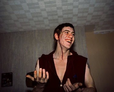 Stewart laughs, bleeding after being punched in the head during a play fight.  'All Dressed up' is a series exploring how various groups of teenagers socialise and the places which are special to them...