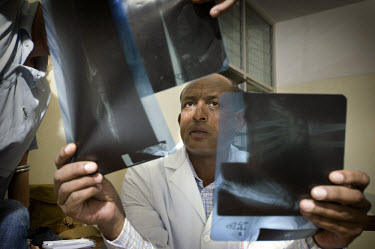 Dr. Asrat Mengiste, an Ethiopian doctor working for the African Medical and Research Foundation (AMREF), examines x-rays at KCMC hospital to see if the bone structure in a deformed hand permits a corr...