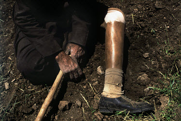 A man, who was injured by a landmine, with a prosthetic leg rests on the ground.