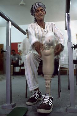 A patient, who was injured by a landmine, fits a prosthetic leg in a rehabilitation centre.