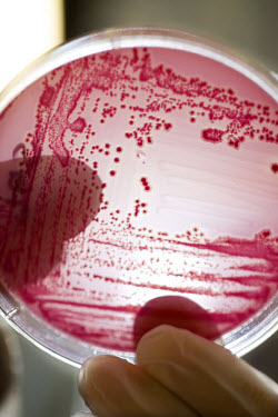 Salmonella bacteria in a petri dish in a lab at the Danish Plant Directorate.