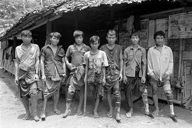 Amputees, all refugees from Burma, at a workshop making artificial limbs for themselves. All but the man on the crutch were Karenni combatants and some lost limbs after standing on mines laid by Karen...