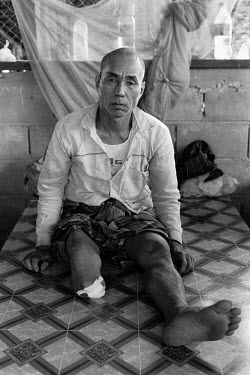 A portrait of a 50-year-old Karen farmer. This man lost his leg after standing on a Burma Army landmine that had been planted in his rice fields. The farmer had to travel to Thailand to receive free t...