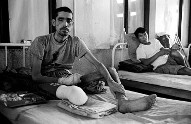 Hari Prasad Pokharel lost his left eye and right leg after going over a landmine planted by the Maoists.