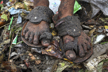 The feet of 13 year old Rahmat Ali collecting rubbish for resale. At the end of each day, he earns TK 55 to 70 (USD 1). The Matuail Dump is one of three waste sites in Dhaka, a city of over ten millio...