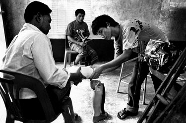 Amputees are fitted with limbs in Mae Tao clinic on the Thai-Burma border. Landmines are used by all sides in the conflict. The Burma Army places mines in areas of their operations to prevent civilian...