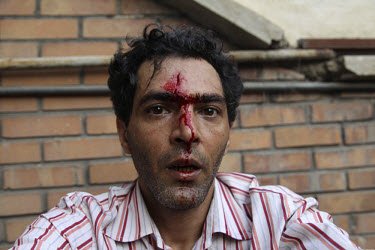 A man injured during clashes on Khosh Street. Following a disputed election result, thousands of supporters of opposition candidate Mir-Hossein Mousavi took to the streets in protest.