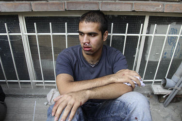 A man injured during clashes on Khosh Street takes shelter at a house nearby. Following a disputed election result, thousands of supporters of opposition candidate Mir-Hossein Mousavi took to the stre...