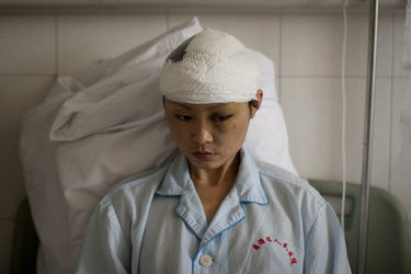 25 year old Liu Huiling recovers in the Number 2 Hospital in Urumqi. She is a kindergarden teacher who was pulled off a bus and beaten by a mob of Uighurs on the 5th July. Ethnic violence between the...