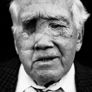 Karl Chromik (born in Germany, 1922), a blinded veteran from the Second World War (WWII). ^All of a sudden, everything turned black. I was not in pain but I felt something on my chest. I heard a frien...