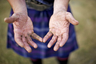 Neil Elliott shows his hands after tossing a caber near his home in Dumbarton. Neil competes in over 40 Highland Games and heavyweight events across the world throughout the summer.