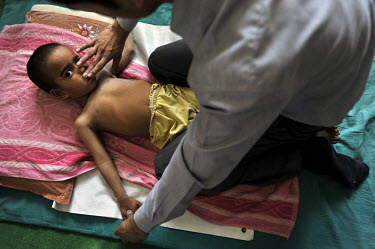 5 year old Ravneet who has birth defects is treated by a doctor at the privately funded Baba Farid Centre in Faridkot. An increasing and ignored percentage of children are being born suffering the sid...
