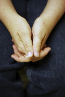 The hands of Jessie White, a patient at the Royal Ottawa Health Care Group. White had served time for child molestation, then he came here as a patient and underwent chemical castration. One of the tr...