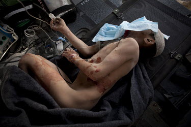 A young boy wounded in a roadside bomb blast is treated in the back of a Charlie Company, Sixth Battalion, 101st Aviation Regiment US Army medevac helicopter near Kandahar.