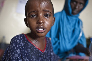 A malnourished young boy with a severe fever in the TFC (Therapeutic Feeding Centre) ward of Galcayo hospital. Galcayo is a town in the self-declared autonomous state of Puntland. The populace in the...
