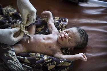 A nurse cuts the umbilical cord of a newborn baby at the regional hospital in Makeni. A year ago Sierra Leone launched a free healthcare plan for pregnant women, breast-feeding mothers and children un...