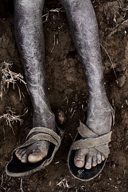 The scarred legs and dried out skin of a child herder.
