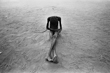 A severely malnourished girl sits on, and plays with the sand in Ajiep, South Sudan.