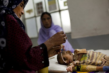 A woman feeds a severely malnourished baby, in the nutrition stabilisation centre in Jamsharoo Civil Hospital. Acute respiratory illnesses and skin diseases are common consequences of malnutrition, du...