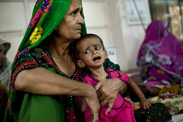 A woman holds a severely malnourished child in the nutrition stabilisation centre in Hyderabad Civil Hospital. Acute respiratory illnesses and skin diseases are common consequences of malnutrition, du...