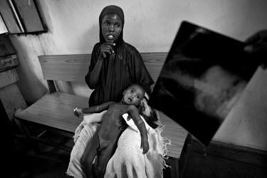 A member of staff at the Banadir Hospital holds an x-ray of Muhammed, a malnourished boy who is sitting on his mother's lap. The east Africa is suffering the worst drought for 60 years and Somalia has...