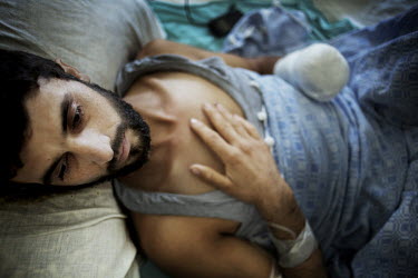 26 year old Fadel Al Sayed lies injured in a Lebanese hospital where his hand was amputated. His house in Syria was bombed and it was four days before Syrian rebels were able to get him out and over t...