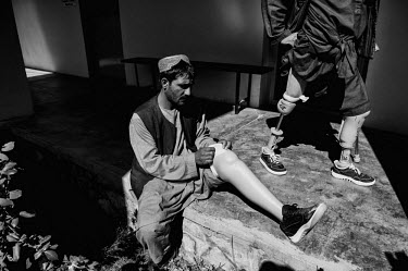 A man examines his prosthetic leg while waiting for an appointment with a doctor at the International Red Cross Orthopedic (ICRC) rehabilitation centre.