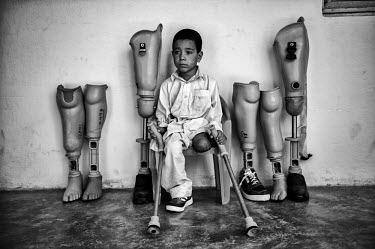 A single leg amputee child sits among a selection of prosthetics at the International Red Cross Orthopedic (ICRC) rehabilitation centre.