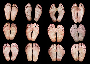 Contestants' feet minutes after they have crossed the finish line of the 24 hour indoor run at Bislett Arena in Oslo at the Bislett Indoor Ultra Challenge and the bicycle race The Big Trial of Strengt...