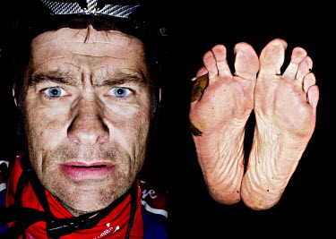 A contestant and his feet after he has finished the bike race The Big Trial of Strength, stretching 540km from Trondheim to Oslo.