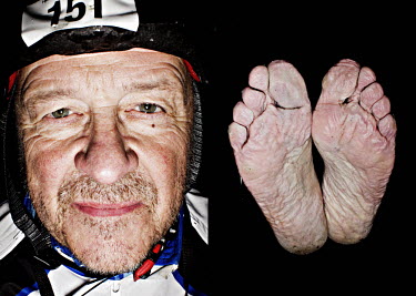 Inge Pedersen and his feet after he has finished the bike race The Big Trial of Strength, stretching 540km from Trondheim to Oslo.