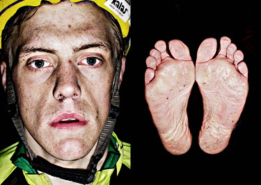 Tom Roar Knutli and his feet after he has finished the bike race The Big Trial of Strength, stretching 540km from Trondheim to Oslo.