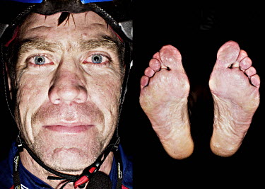 A contestant and his feet after he has finished the bike race The Big Trial of Strength, stretching 540km from Trondheim to Oslo.