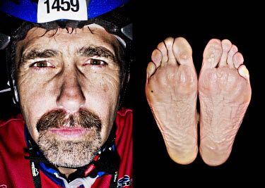 Frode Tufteland and his feet after he has finished the bike race The Big Trial of Strength, stretching 540km from Trondheim to Oslo.